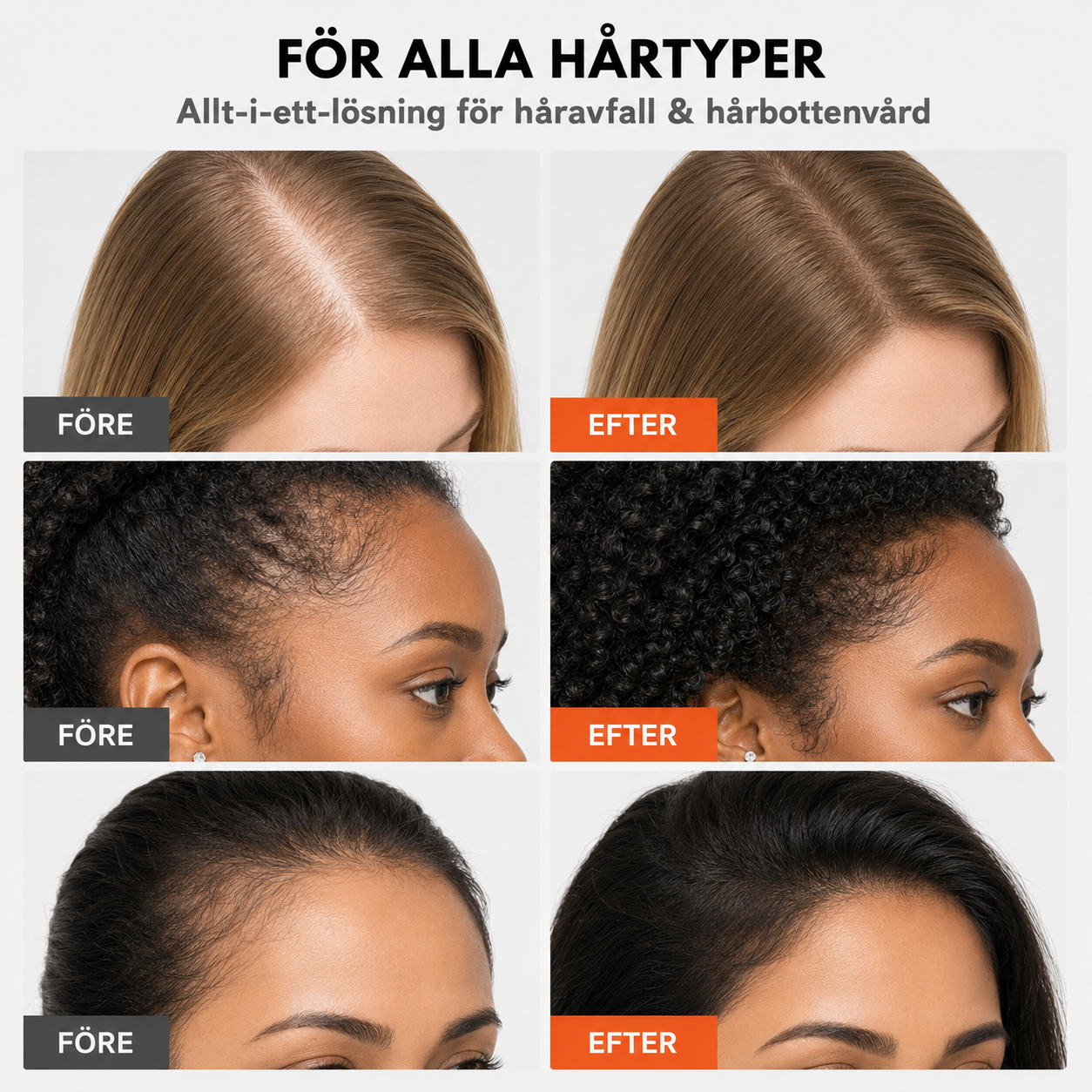 RootRise Hair Growth Serum
